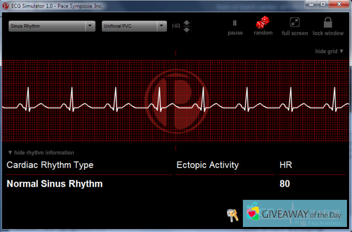 ecg software for pc free download